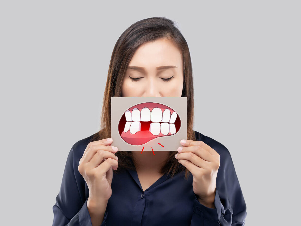 Understanding The Impact of Tooth Loss on Dental Alignment