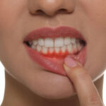 5 Warning Signs of Gum Disease You Shouldn't Ignore